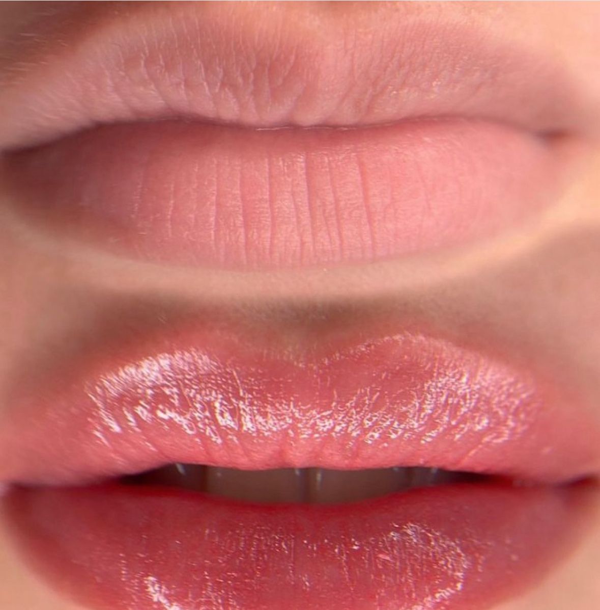 Resultado de micropigmentação labial com efeito Hydra Gloss